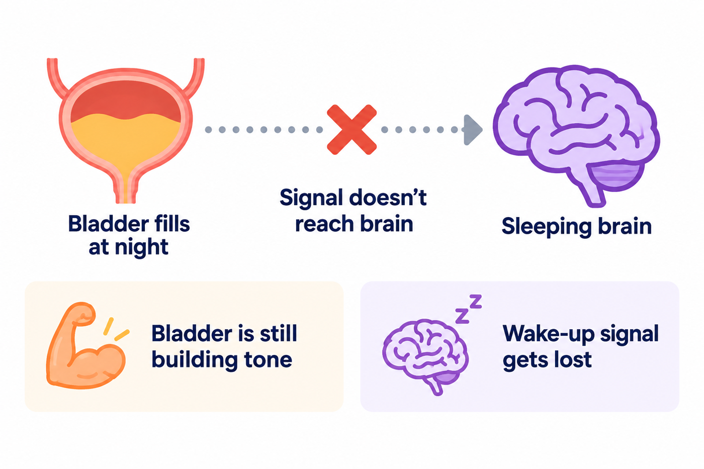 Infographic: the bladder fills and rings at night, but the wake-up signal does not reach the sleeping brain. His bladder is still building tone, and the wake-up signal gets lost.