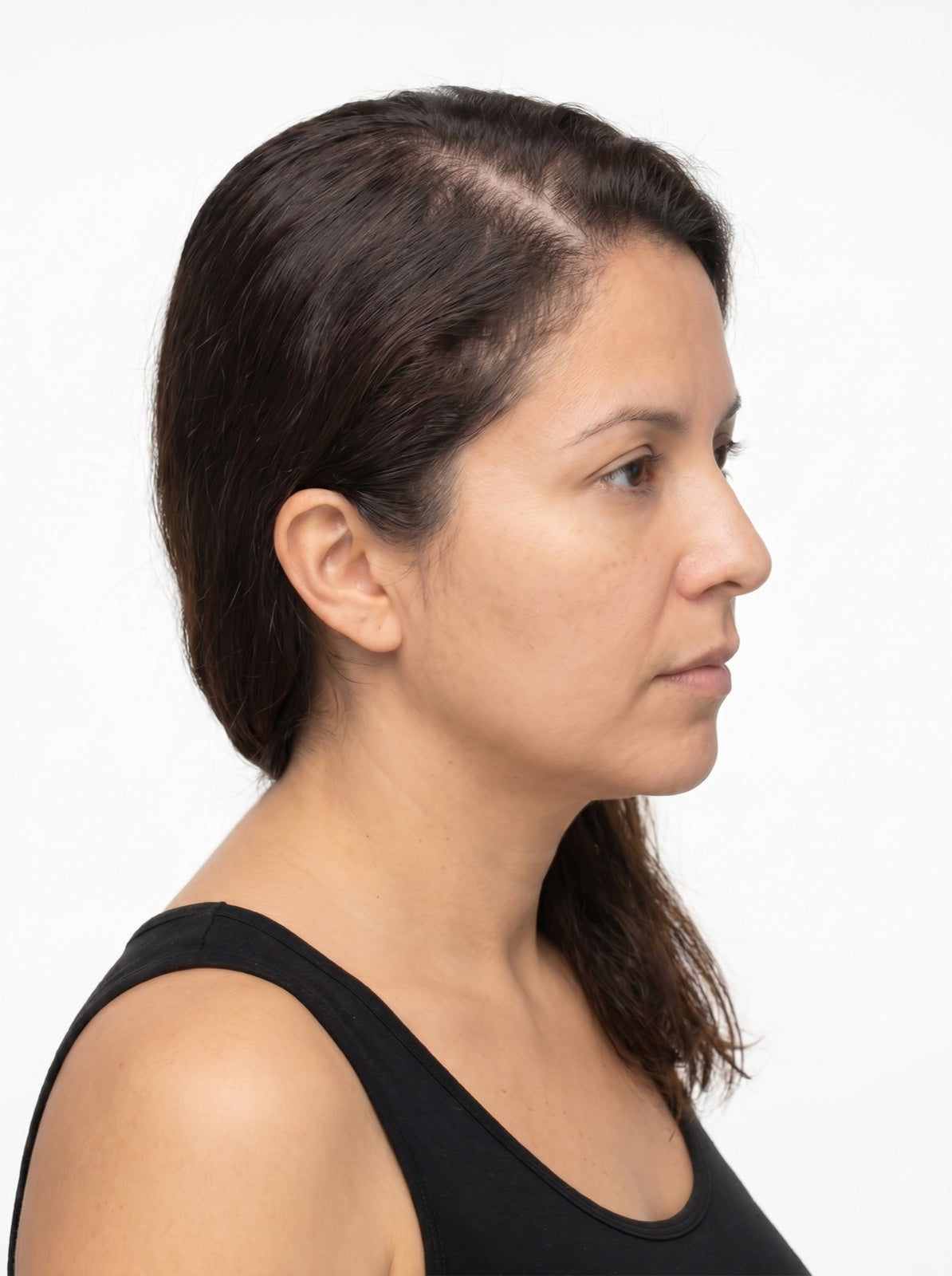 Maria R. after