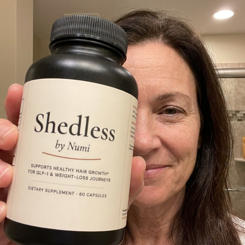 Shedless customer