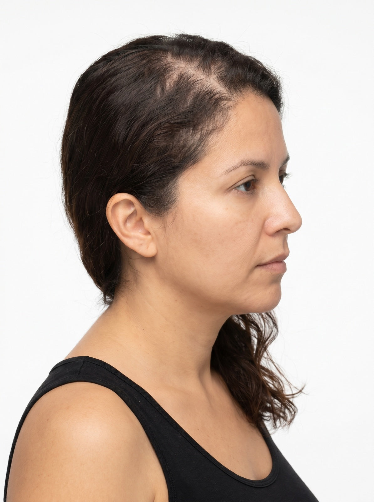 Maria R. before